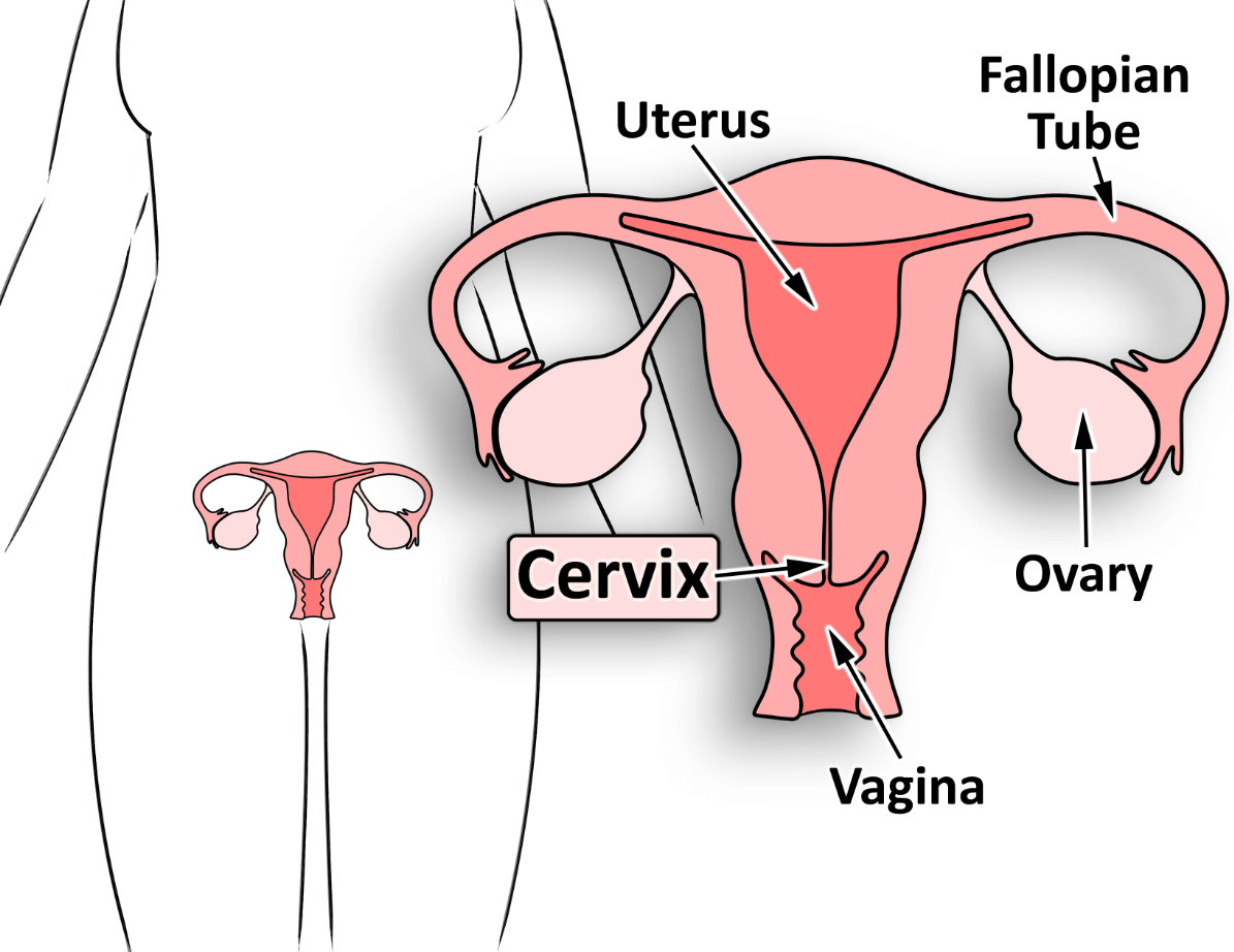 cervical-cancer-symptoms-causes-diagnosis-treatment-prevention-more