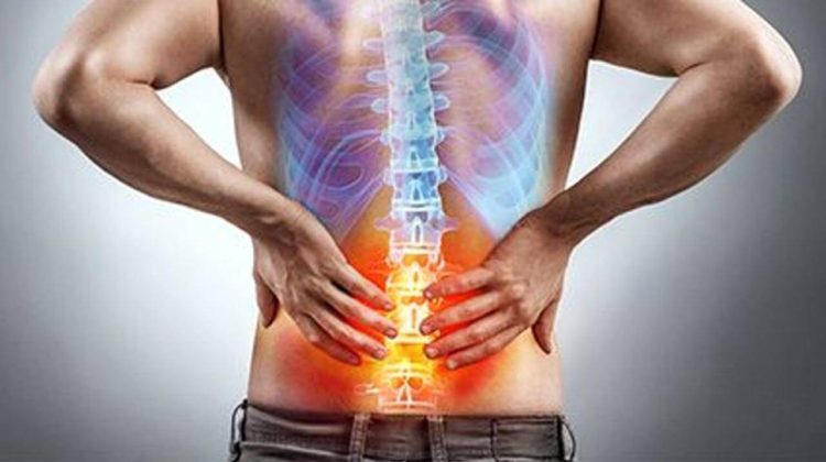 Spinal Fusion Complications years later