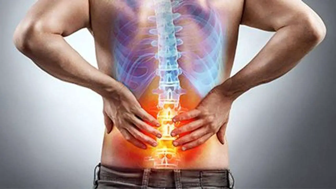 Spinal Fusion Complications years later