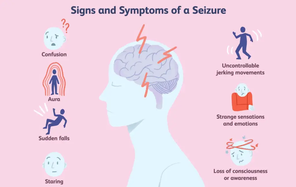 Epilepsy: Symptoms, Causes, Diagnosis, Treatment, and More
