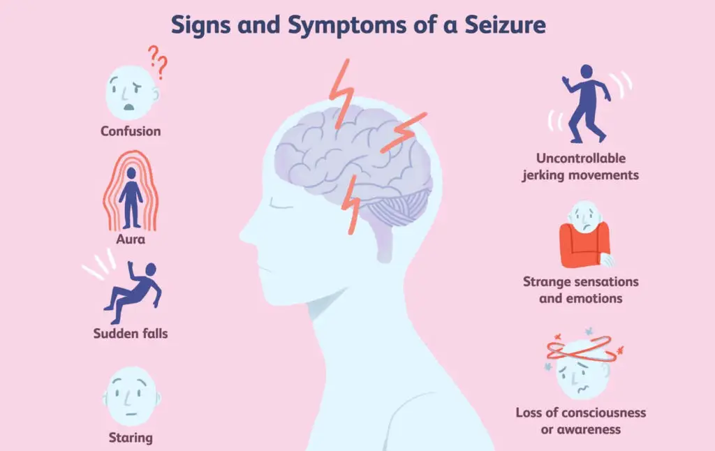 Epilepsie Symptome Die 23 Anzeichen - Rezfoods - Resep Masakan Indonesia