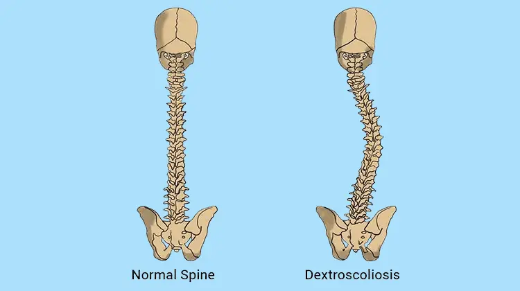 spine definition