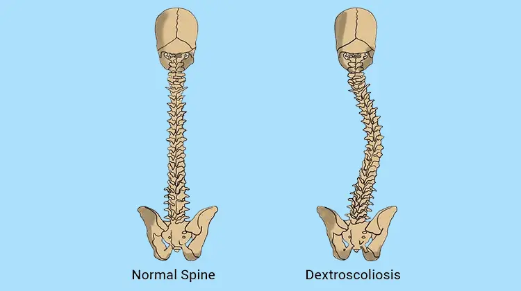 Spine Definition Tiklopub