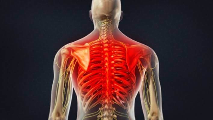 Thoracic Back Pain Causes Symptoms Diagnosis And Treatment